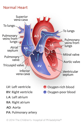 Hypoplastic Left Heart Syndrome Illustration