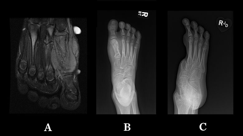 C.K.'s foot X-rays