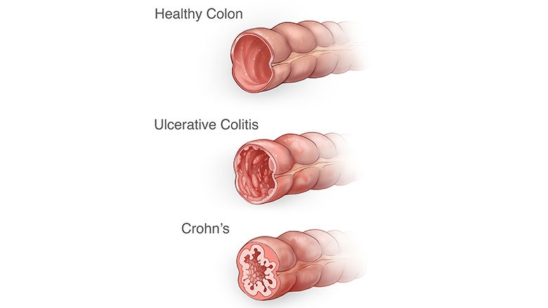 Cross sections of the colon illustration