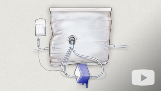 Artificial womb device illustration