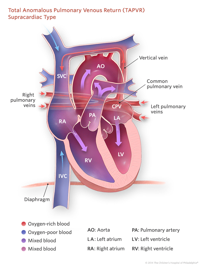 venous return