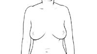 Illustration of breast self-examination, step 1, arms at side