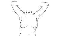 Illustration of breast self-examination, step 2, arms raised