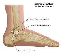 Illustration demonstrating the three ligaments involved in ankle sprains/strains