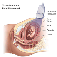 Illustration of transabdominal fetal ultrasound