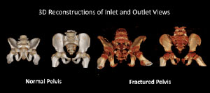 3D reconstruction of inlet and outlet views