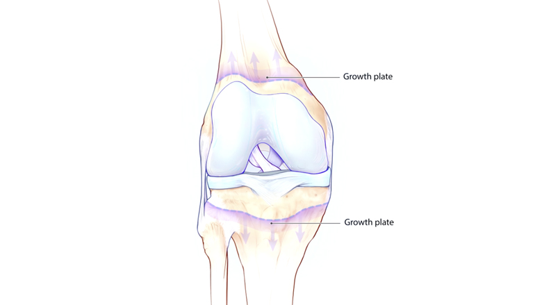 Growth plate