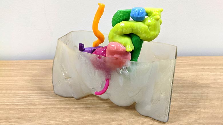 CHOP Radiology and Urology Collaborate on 3-D Printing Method to Build Pediatric Urology Models