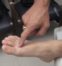 Toe/ Ankle dorsiflexion