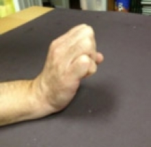  Wrist Extension: Radial nerve