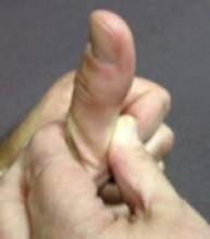 Thumb extension