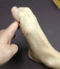 Tibial Nerve: Test with plantar flexion foot/toes