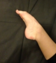 Tibial Nerve: Test with plantar flexion foot/toes