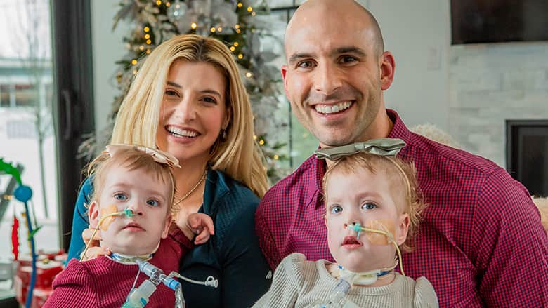 The Separation of Conjoined Twins Lily and Addy Altobelli | Children's  Hospital of Philadelphia