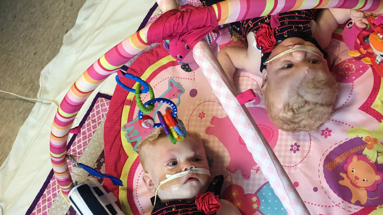 Delaney Twins lying on play mat together post separation