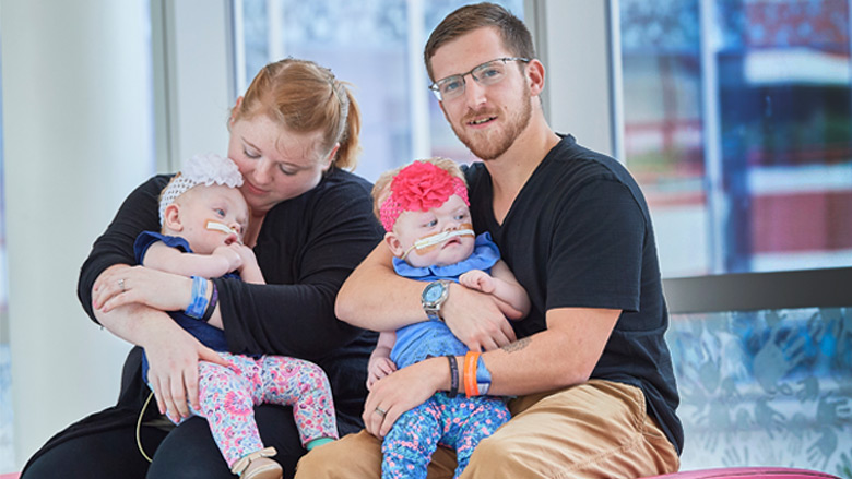 Here's What Conjoined Twins Abby and Brittany Are Up To