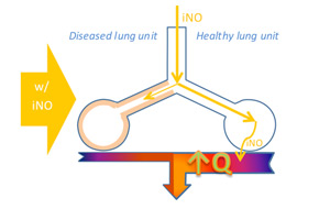 Diseased vs healthy lung unit with iNO