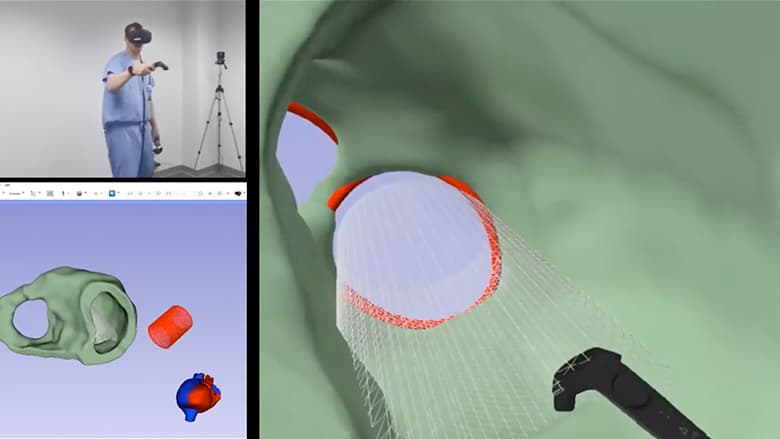 Dr. Jolley Simulated Cardiac Device Virtual Reality