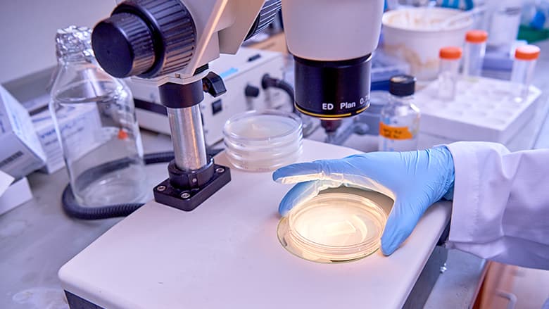 Hand holding dish under microscope Hand holding dish under microscope