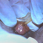 Severe granulation