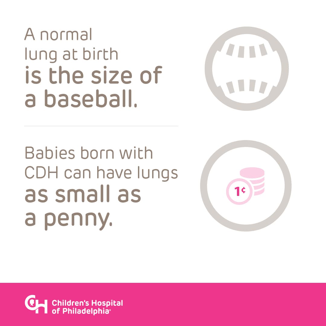 Babies born with CDH can have lungs as small as a penny. In comparison, a normal lung at birth is the size of a baseball