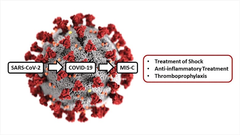 Treating MIS-C illustration