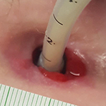 Moderate enlargement example 1