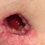 Severe enlargement example 2