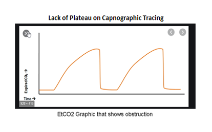 Lack of Plateau