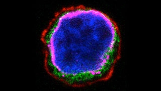 Photograph of an acute lymphoblastic leukemia cell