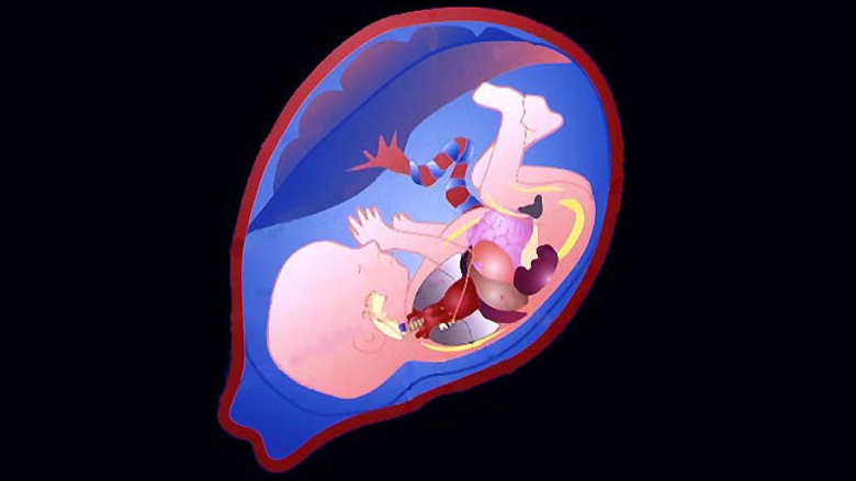 fetal surgery experience CME title slide