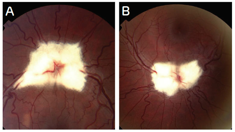 Images of optic nerve heads and vessels