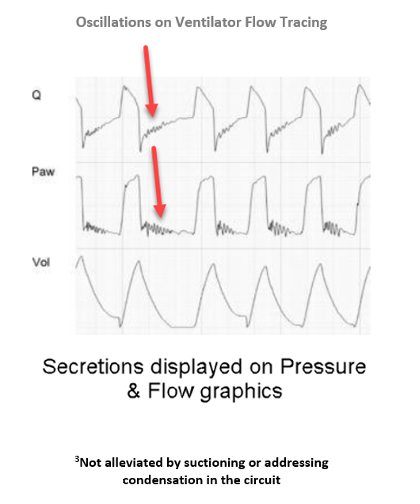 Oscillations on Ventilator Flow Tracking