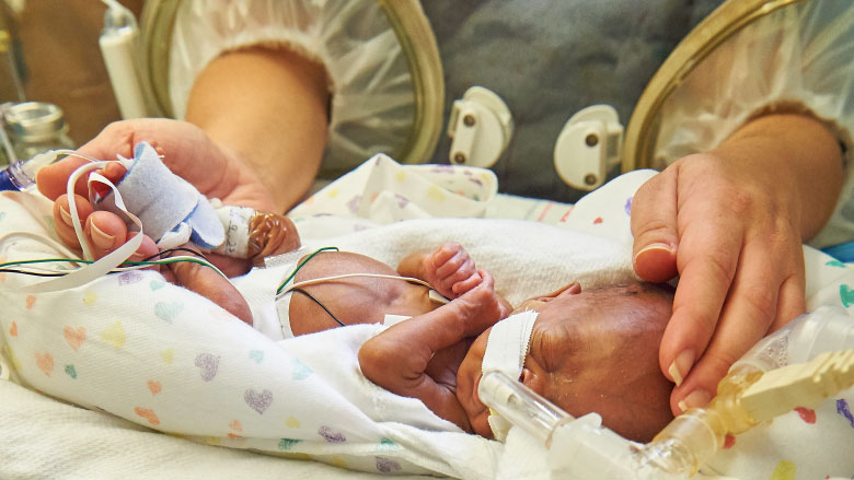 Premature baby Premature baby