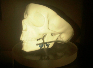skull