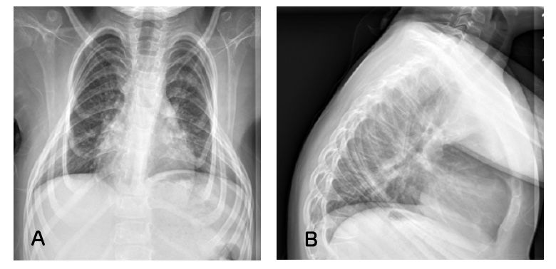 Figure 4 Figure 4