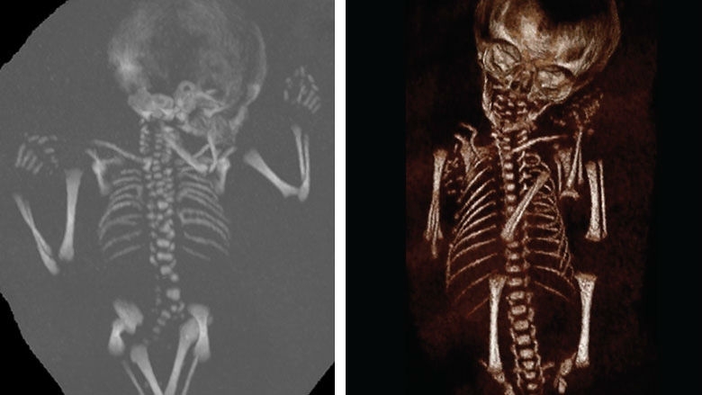 Fetal CT Imaging