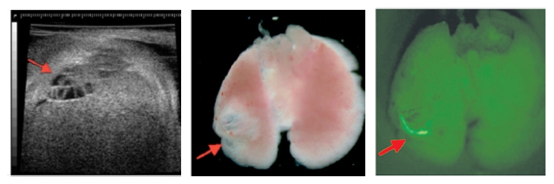 CCAM-like malformation in fetal rat lung