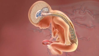 MOMS fetus repair illustration