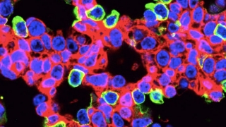 CRISPR-edited lung cells
