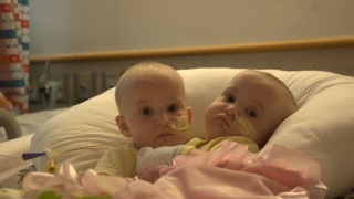 Amelia and Allison before surgery