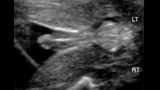 male genitalia ultrasound