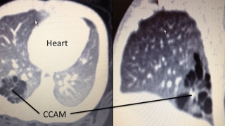 postnatal ct scan images at five weeks