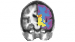 right brain image