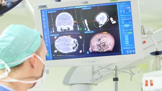 Neurosurgeon looking at computer screen displaying brain scans