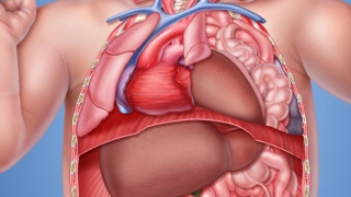 Congenital Diaphragmatic Hernia (CDH) Internal View of Abdomen