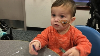 Matthew crohns disease patient at 1 year old with NG tube