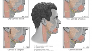 Facial nerve anatomy - Thumbnail