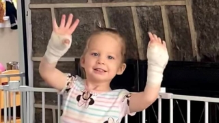 Madelyn after surgery showing her wrapped hands