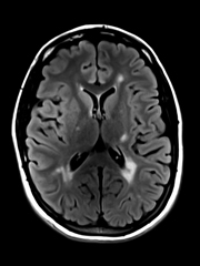 3T Brain MRI